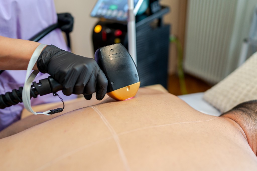 Επαγγελματική θεραπεία laser στο Face & Shape