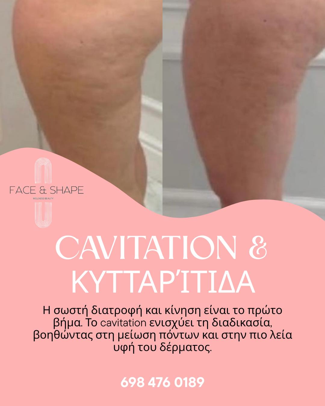 Πριν 2