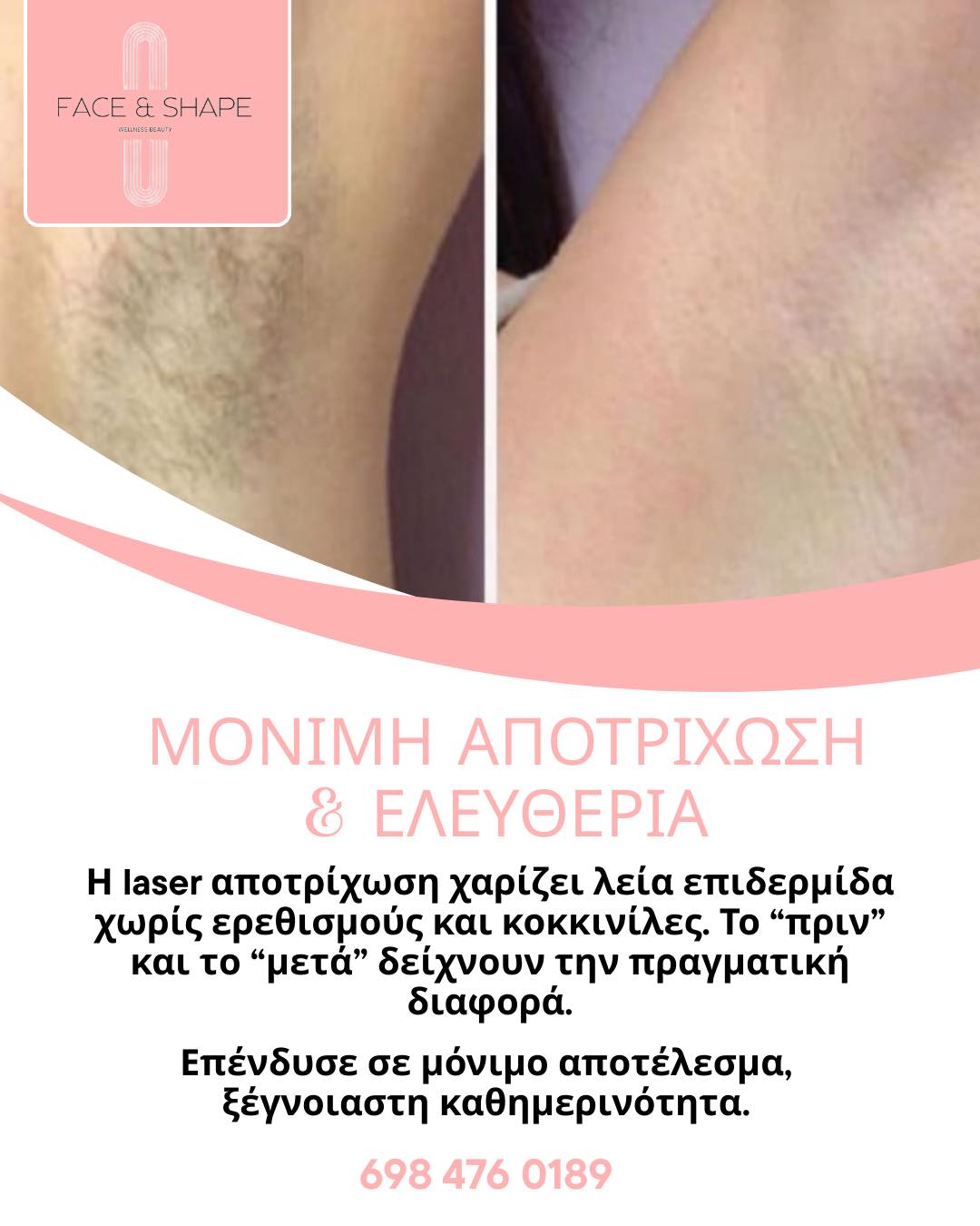 Μετά 2